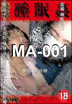 MA-00160 